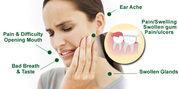 What are the symptoms of an infected wisdom tooth?