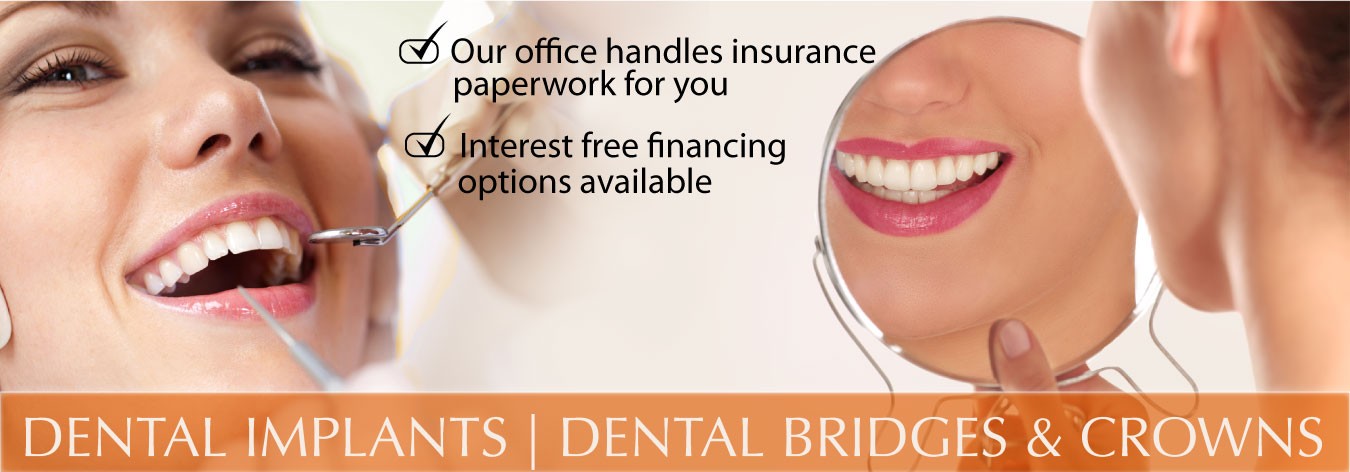 dental implants-dental bridges and crowns