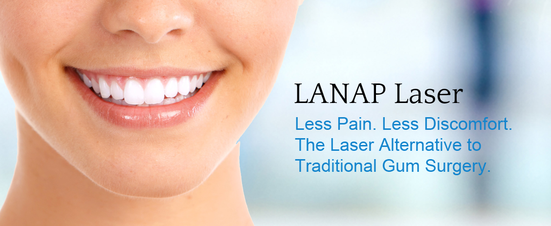 More About LANAP And Its Benefits Over Traditional Gum Surgery