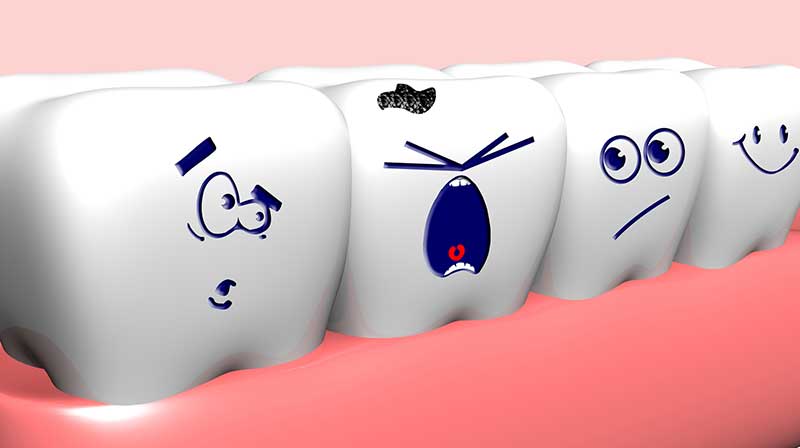 Tooth-decay-prevention