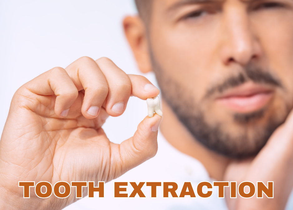 The Things You Need to Know about Tooth Extraction